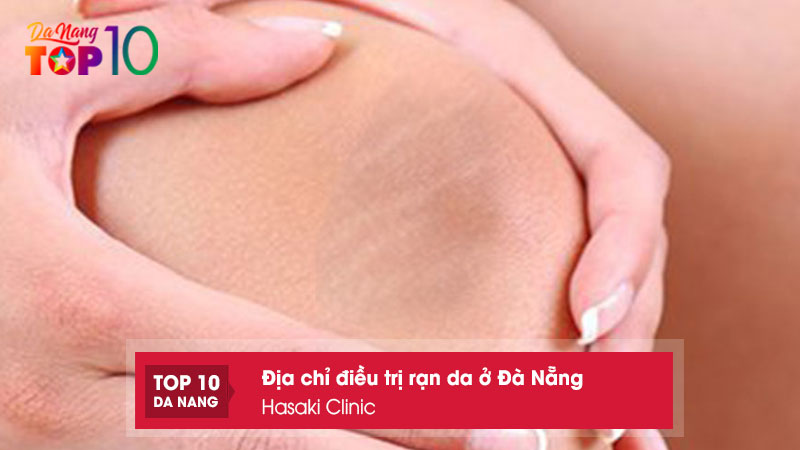 Hasaki-clinic-top10danang