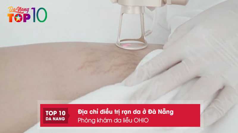 Phong-kham-da-lieu-ohio-top10danang