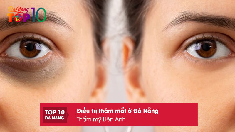 Tham-my-lien-anh-top10danang