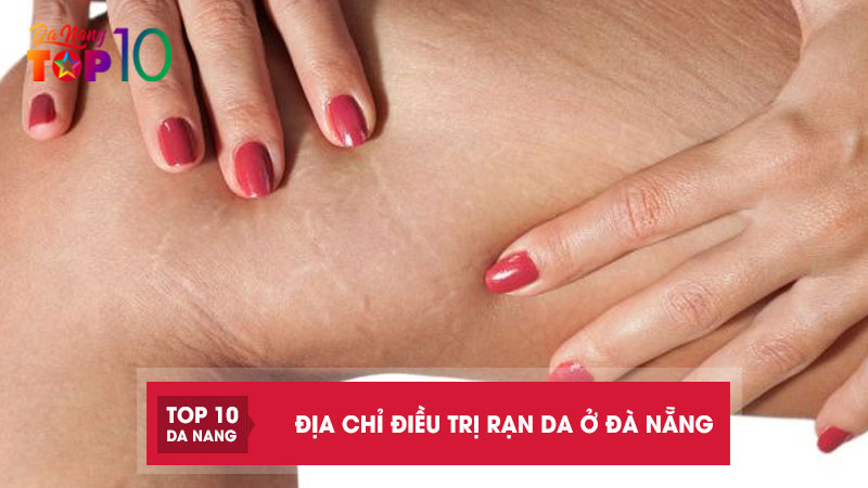 Top-10-dia-chi-dieu-tri-ran-da-o-da-nang-hieu-qua-nhanh-chong-top10danang