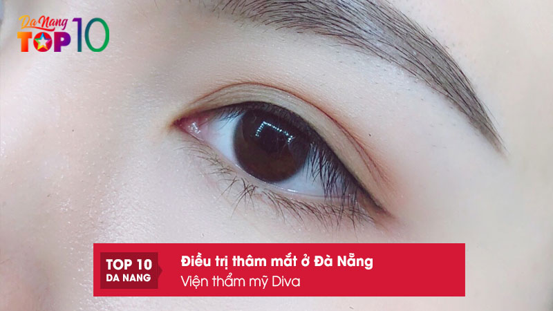 Vien-tham-my-diva-top10danang