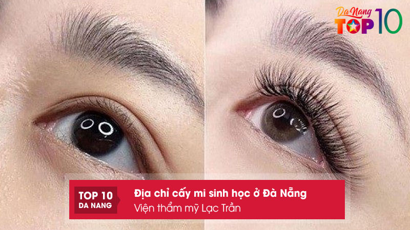 Vien-tham-my-lac-tran-top10danang
