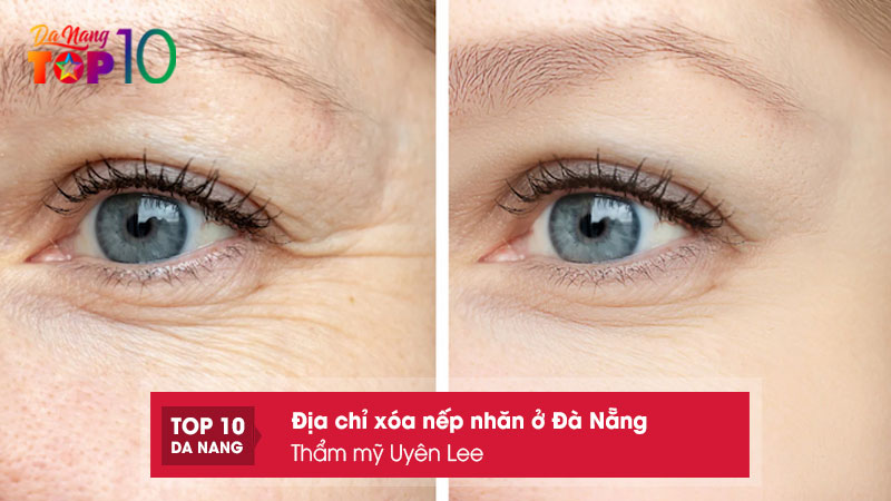 Tham-my-uyen-lee-top10danang