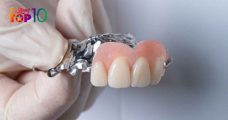 So-sanh-chi-phi-uu-nhuoc-diem-cac-loai-rang-gia-thao-lap1-top10danang