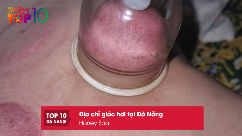 Honey-spa-top10danang