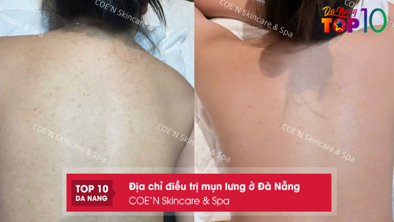 Coen-skincare-spa-top10danang